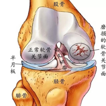 保健品氨糖软骨素钙片能长期服用吗？怎么吃才好-第1张图片-关节保镖