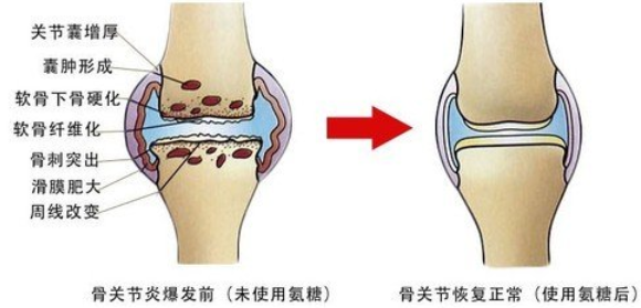 氨糖软骨素钙片哪个厂家的好？你选对了么？-第1张图片-关节保镖