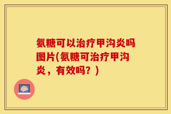 氨糖可以治疗甲沟炎吗图片(氨糖可治疗甲沟炎，有效吗？)