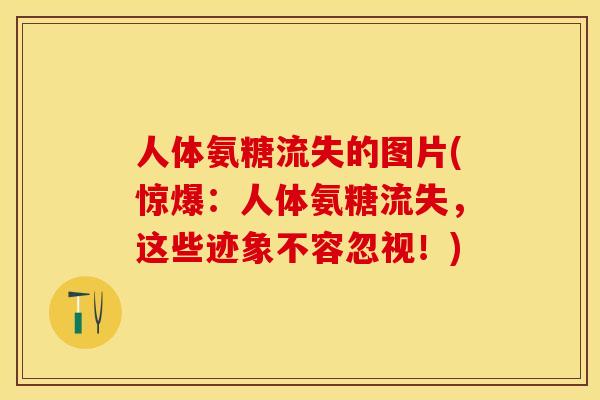 人体氨糖流失的图片(惊爆：人体氨糖流失，这些迹象不容忽视！)-第1张图片-关节保镖