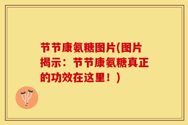 节节康氨糖图片(图片揭示：节节康氨糖真正的功效在这里！)-第1张图片-关节保镖