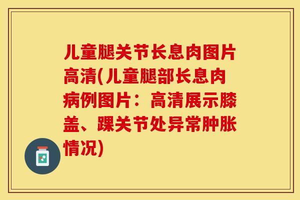 儿童腿关节长息肉图片高清(儿童腿部长息肉病例图片：高清展示膝盖	、踝关节处异常肿胀情况)-第1张图片-关节保镖
