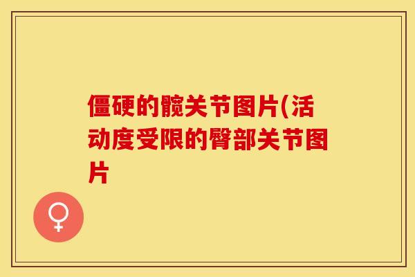 僵硬的髋关节图片(活动度受限的臀部关节图片-第1张图片-关节保镖
