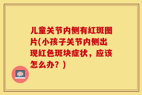 儿童关节内侧有红斑图片(小孩子关节内侧出现红色斑块症状，应该怎么办？)-第1张图片-关节保镖