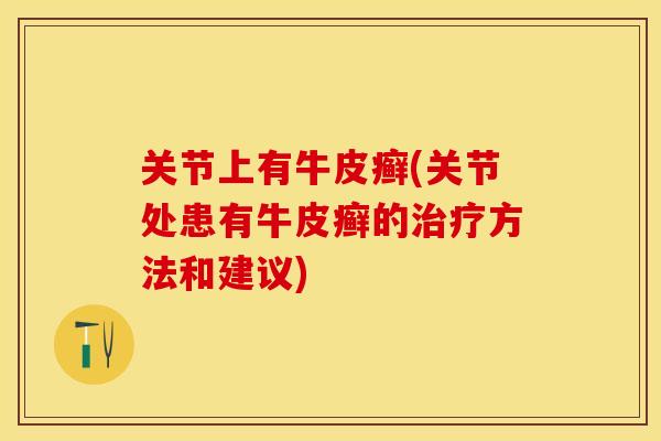 关节上有牛皮癣(关节处患有牛皮癣的治疗方法和建议)-第1张图片-关节保镖