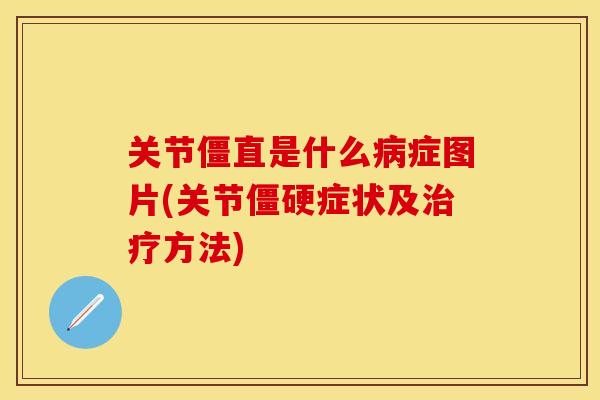 关节僵直是什么病症图片(关节僵硬症状及治疗方法)-第1张图片-关节保镖