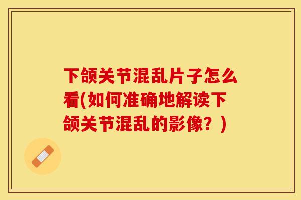 下颌关节混乱片子怎么看(如何准确地解读下颌关节混乱的影像？)-第1张图片-关节保镖