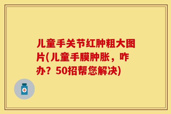 儿童手关节红肿粗大图片(儿童手膜肿胀，咋办？50招帮您解决)-第1张图片-关节保镖