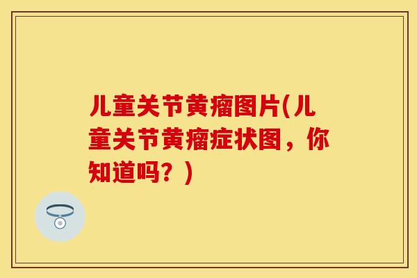 儿童关节黄瘤图片(儿童关节黄瘤症状图，你知道吗？)-第1张图片-关节保镖