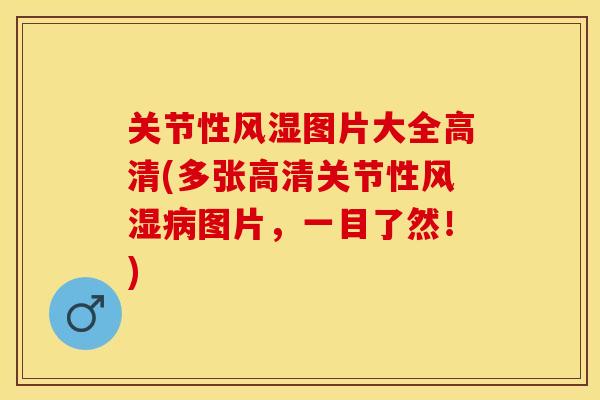 关节性风湿图片大全高清(多张高清关节性风湿病图片，一目了然！)-第1张图片-关节保镖