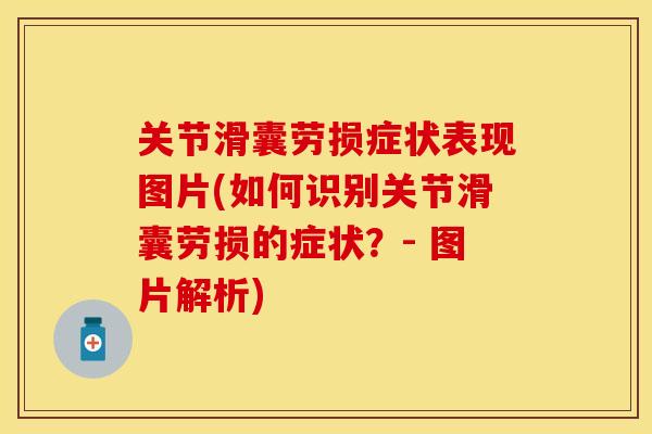 关节滑囊劳损症状表现图片(如何识别关节滑囊劳损的症状？- 图片解析)-第1张图片-关节保镖