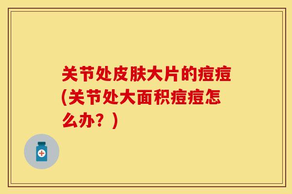 关节处皮肤大片的痘痘(关节处大面积痘痘怎么办？)-第1张图片-关节保镖