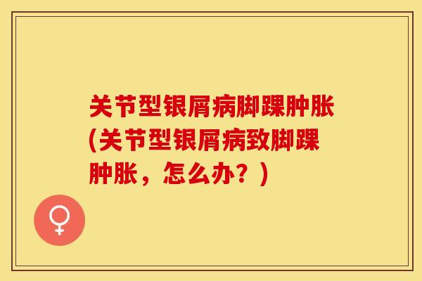 关节型银屑病脚踝肿胀(关节型银屑病致脚踝肿胀，怎么办？)