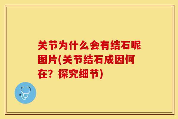 关节为什么会有结石呢图片(关节结石成因何在？探究细节)-第1张图片-关节保镖