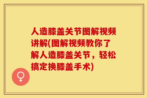 人造膝盖关节图解视频讲解(图解视频教你了解人造膝盖关节，轻松搞定换膝盖手术)-第1张图片-关节保镖