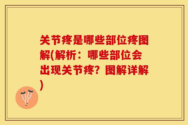 关节疼是哪些部位疼图解(解析：哪些部位会出现关节疼？图解详解)-第1张图片-关节保镖