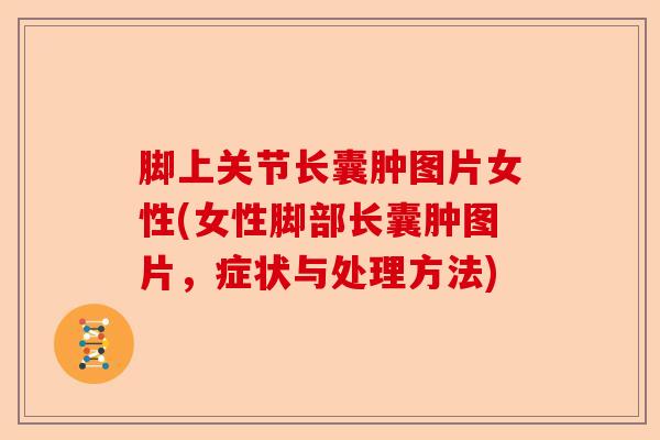 脚上关节长囊肿图片女性(女性脚部长囊肿图片，症状与处理方法)-第1张图片-关节保镖