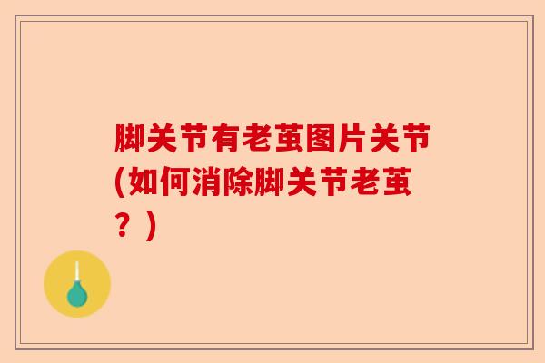 脚关节有老茧图片关节(如何消除脚关节老茧？)-第1张图片-关节保镖