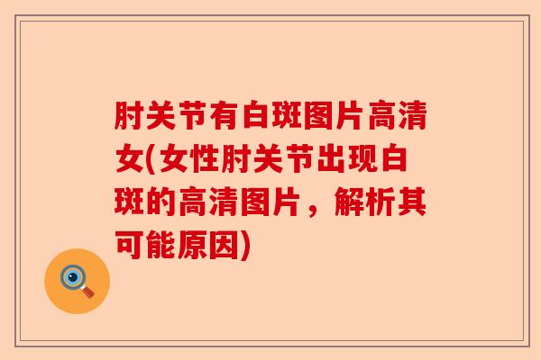 肘关节有白斑图片高清女(女性肘关节出现白斑的高清图片，解析其可能原因)-第1张图片-关节保镖