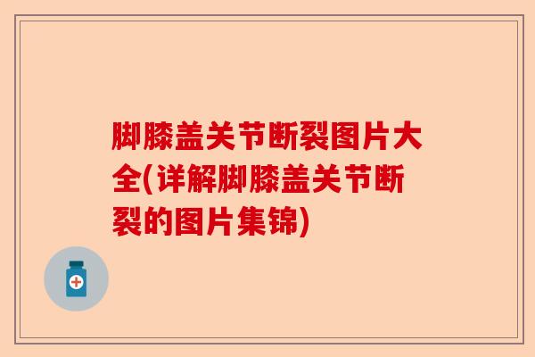 脚膝盖关节断裂图片大全(详解脚膝盖关节断裂的图片集锦)-第1张图片-关节保镖