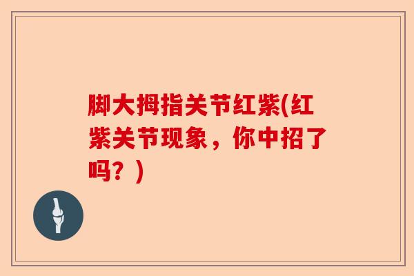 脚大拇指关节红紫(红紫关节现象，你中招了吗？)-第1张图片-关节保镖
