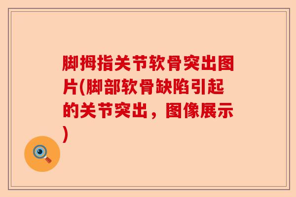 脚拇指关节软骨突出图片(脚部软骨缺陷引起的关节突出，图像展示)-第1张图片-关节保镖