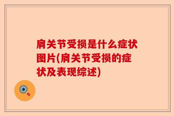 肩关节受损是什么症状图片(肩关节受损的症状及表现综述)-第1张图片-关节保镖