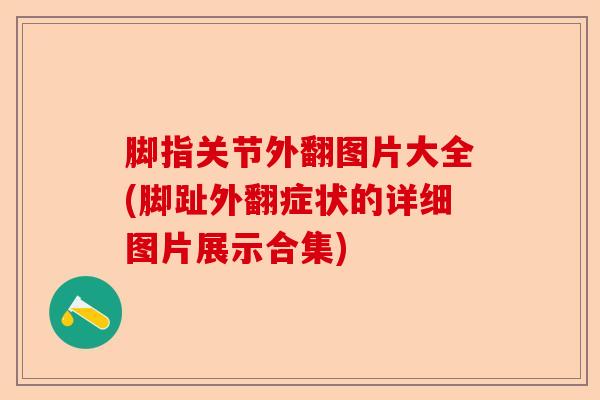 脚指关节外翻图片大全(脚趾外翻症状的详细图片展示合集)-第1张图片-关节保镖