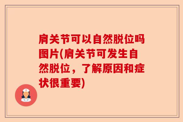 肩关节可以自然脱位吗图片(肩关节可发生自然脱位，了解原因和症状很重要)-第1张图片-关节保镖