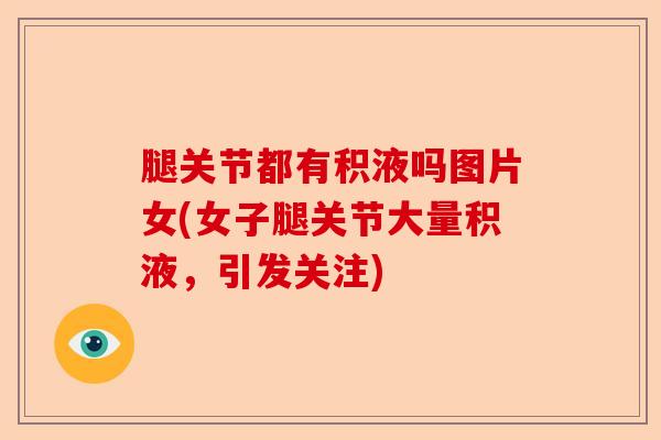 腿关节都有积液吗图片女(女子腿关节大量积液，引发关注)-第1张图片-关节保镖