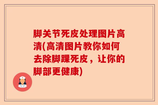 脚关节死皮处理图片高清(高清图片教你如何去除脚踝死皮，让你的脚部更健康)-第1张图片-关节保镖