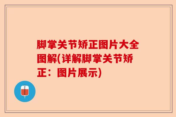 脚掌关节矫正图片大全图解(详解脚掌关节矫正：图片展示)-第1张图片-关节保镖