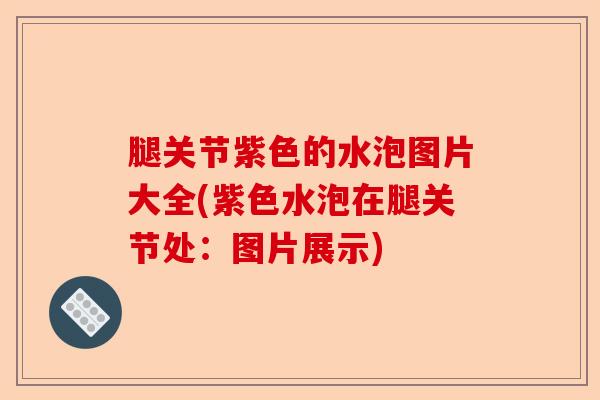 腿关节紫色的水泡图片大全(紫色水泡在腿关节处：图片展示)-第1张图片-关节保镖