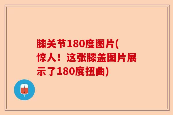 膝关节180度图片(惊人！这张膝盖图片展示了180度扭曲)-第1张图片-关节保镖
