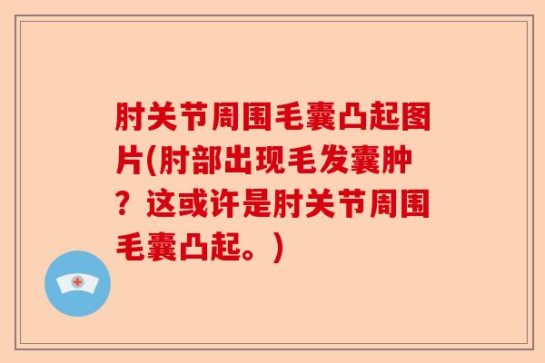 肘关节周围毛囊凸起图片(肘部出现毛发囊肿？这或许是肘关节周围毛囊凸起。)