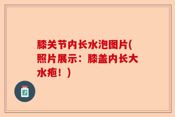 膝关节内长水泡图片(照片展示：膝盖内长大水疱！)-第1张图片-关节保镖
