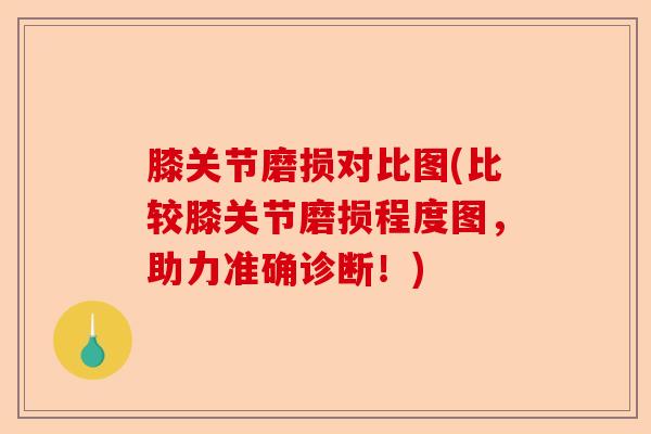 膝关节磨损对比图(比较膝关节磨损程度图，助力准确诊断！)-第1张图片-关节保镖