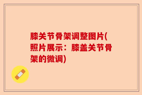 膝关节骨架调整图片(照片展示：膝盖关节骨架的微调)-第1张图片-关节保镖