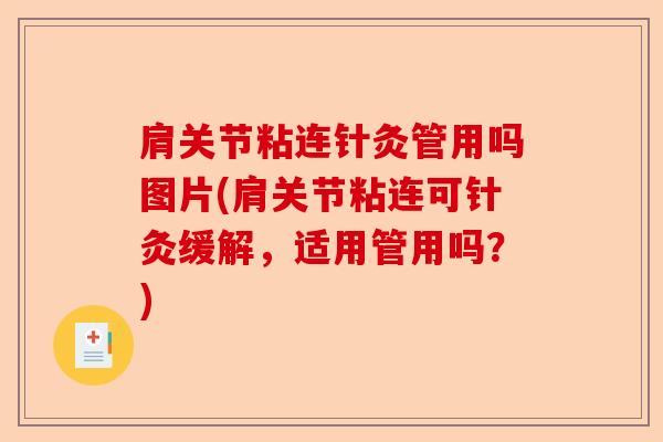 肩关节粘连针灸管用吗图片(肩关节粘连可针灸缓解，适用管用吗？)-第1张图片-关节保镖