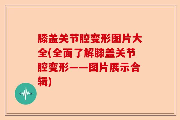 膝盖关节腔变形图片大全(全面了解膝盖关节腔变形——图片展示合辑)-第1张图片-关节保镖