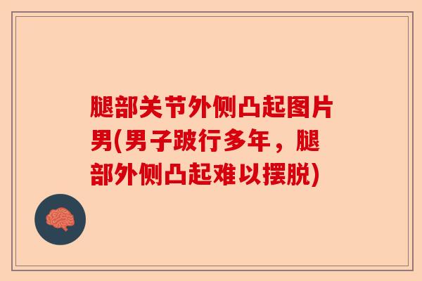 腿部关节外侧凸起图片男(男子跛行多年，腿部外侧凸起难以摆脱)-第1张图片-关节保镖
