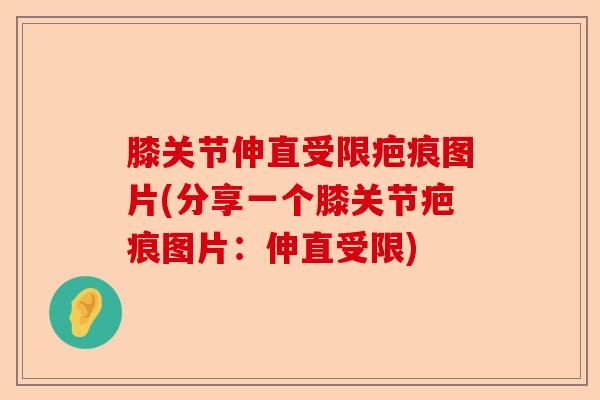 膝关节伸直受限疤痕图片(分享一个膝关节疤痕图片：伸直受限)-第1张图片-关节保镖
