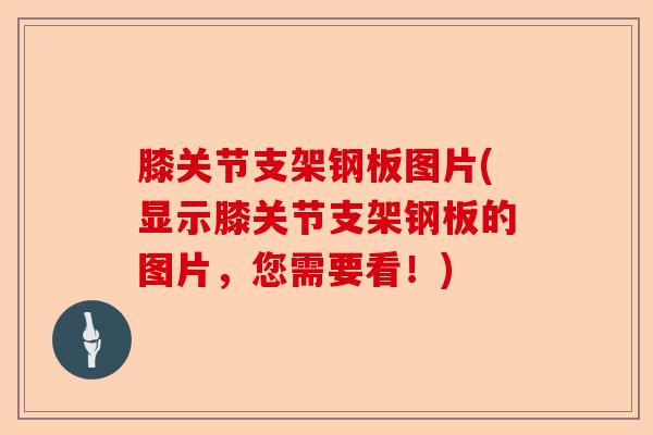 膝关节支架钢板图片(显示膝关节支架钢板的图片，您需要看！)-第1张图片-关节保镖