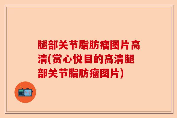 腿部关节脂肪瘤图片高清(赏心悦目的高清腿部关节脂肪瘤图片)-第1张图片-关节保镖