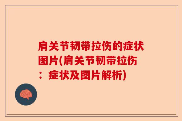 肩关节韧带拉伤的症状图片(肩关节韧带拉伤：症状及图片解析)-第1张图片-关节保镖