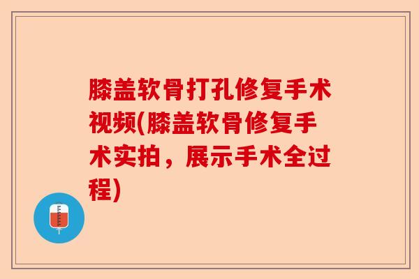 膝盖软骨打孔修复手术视频(膝盖软骨修复手术实拍，展示手术全过程)-第1张图片-关节保镖