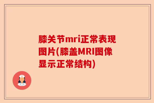 膝关节mri正常表现图片(膝盖MRI图像显示正常结构)-第1张图片-关节保镖
