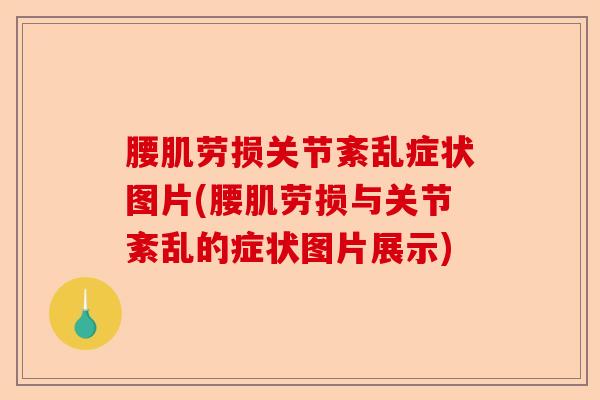 腰肌劳损关节紊乱症状图片(腰肌劳损与关节紊乱的症状图片展示)-第1张图片-关节保镖