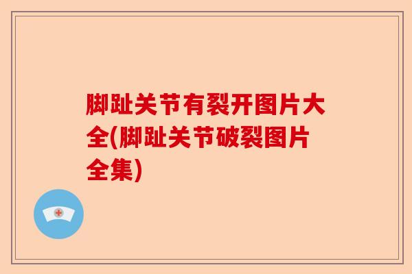 脚趾关节有裂开图片大全(脚趾关节破裂图片全集)-第1张图片-关节保镖