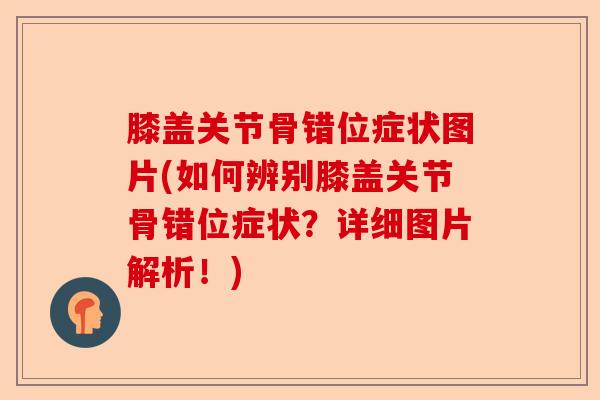 膝盖关节骨错位症状图片(如何辨别膝盖关节骨错位症状？详细图片解析！)-第1张图片-关节保镖